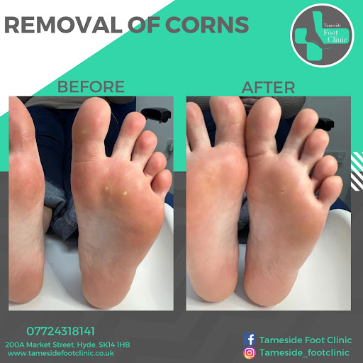 Tameside Foot Clinic - Thumbnail