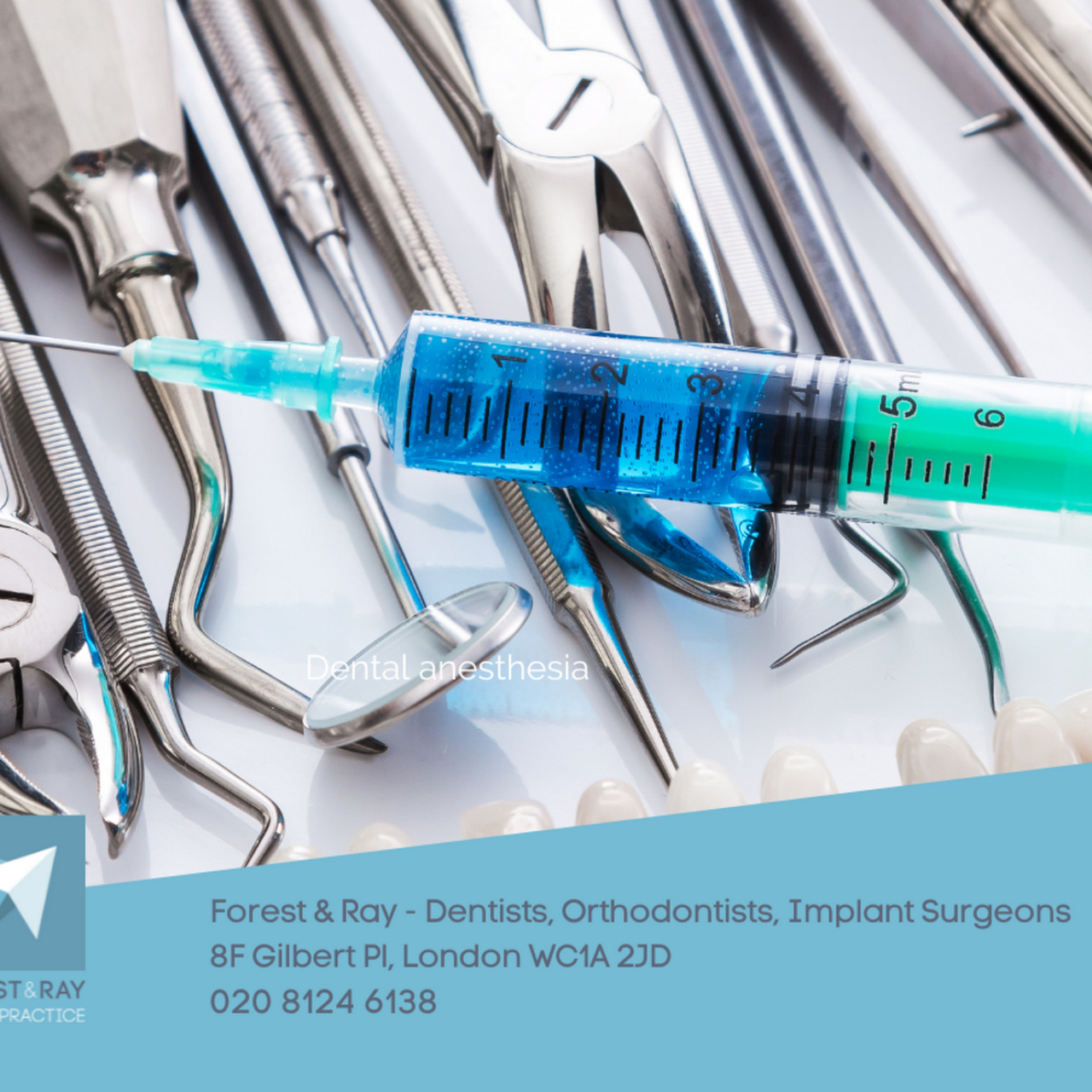 Posted on Jan 14, 2024Dental anesthesia a spectrum of