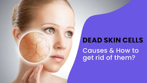 👉🏽 Dead Skin Cells