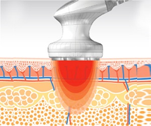 Perfect body remodelare - Târgu Jiu