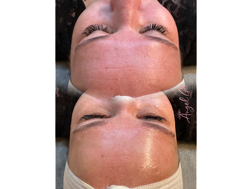 Angel Glō Skincare