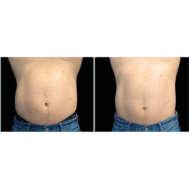 Euphoria Aesthetics & Laser photo 33