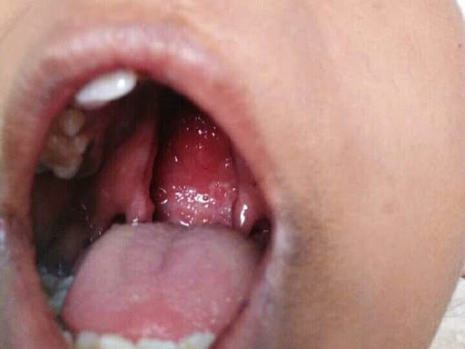 Cured within 3 weeks  (Dr Soumya Dey's Clinic desk)  post image