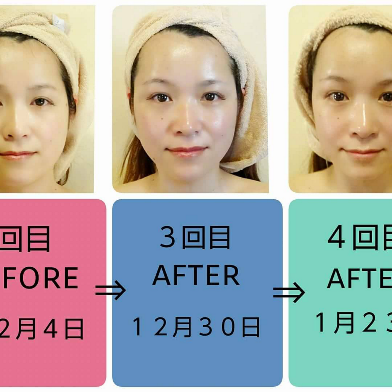 ラ モーレ コルギエステサロン エステティック サロン