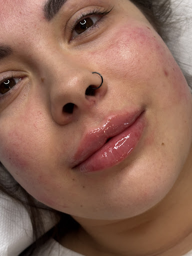 RoseNeedleAesthetics