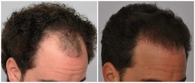 Photos of Borna Medical Spa Laser Center branch