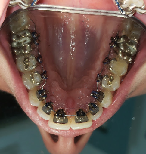 Studio Dentistico Dott. Cosimo Papale - Thumbnail