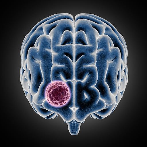 Are you looking for expert care to manage brain tumor conditions with precision and safety? Dr. V… post image
