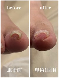 芦屋巻き爪センター