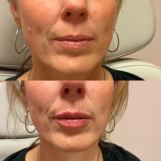 Blush and Bloom MedSpa