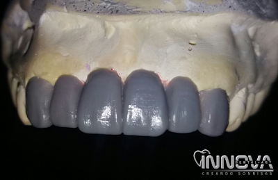 Photos of Innova Dental Art
