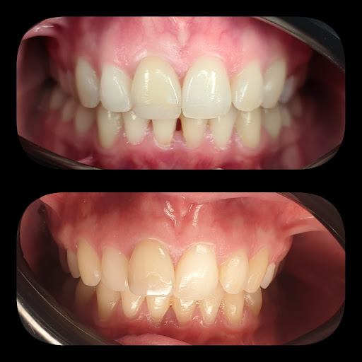 Woodbury Park Dental Surgery Tunbridge Wells - Thumbnail