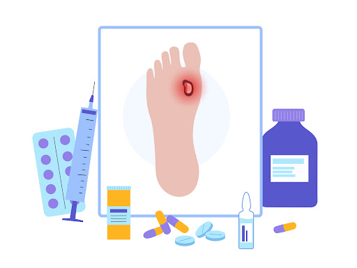 Effective diabetes wound care involves regular monitoring, proper cleaning, and timely treatment… post image