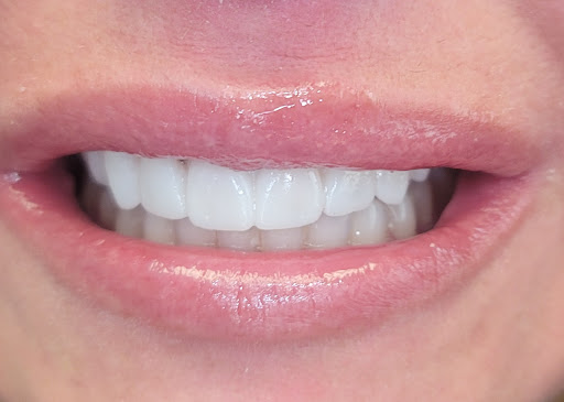 CLE Smiles by Dr. Niki: Nicole Cochran, DDS