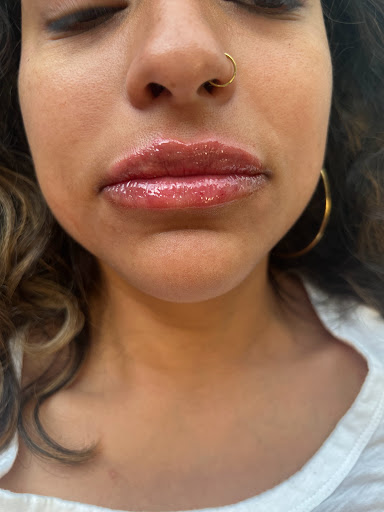 Refreshed Medical Aesthetics