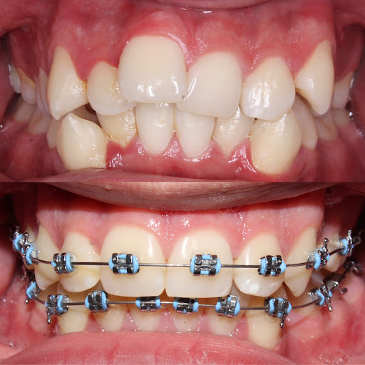 Dr. MAURICIO GONZALEZ ODONTOPEDIATRA / ORTODONCIA Gallery - Mexico