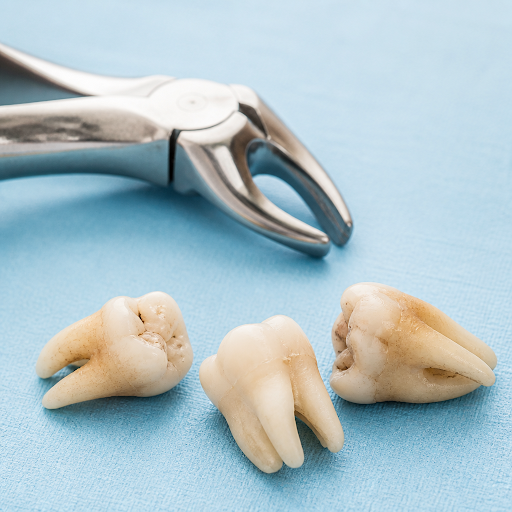 Not every tooth extraction is the same. At Dr. Urvi's Dental Hub in Urban Estate Dugri, Ludhiana,…
