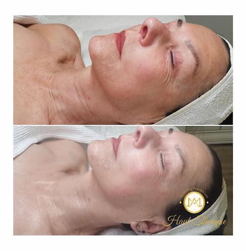Haut Therapie - Marilena Asiminoaei | Kosmetikstudio - Thumbnail
