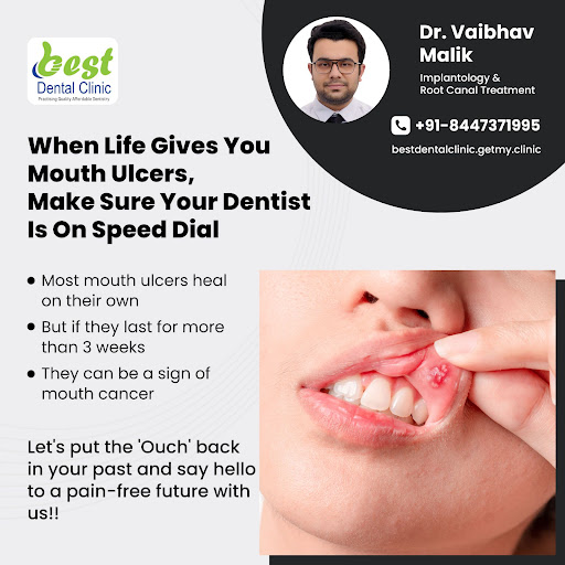 Mouth ulcers that take longer than 3 weeks to heal can be signs of underlying health issues. Cons… post image