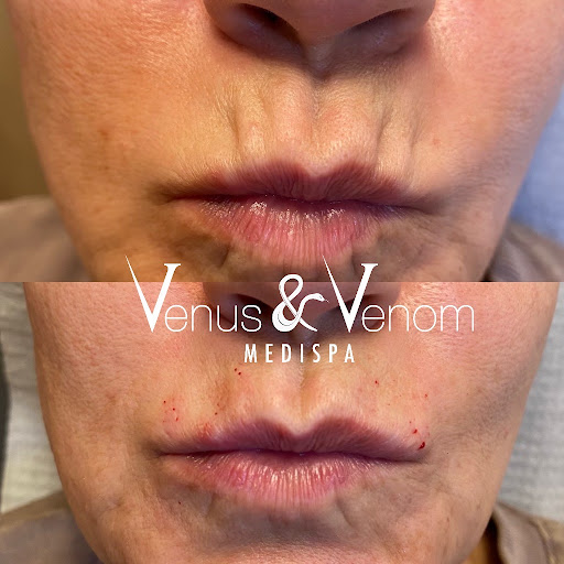 Venus & Venom MEDIspa Monroe - Thumbnail