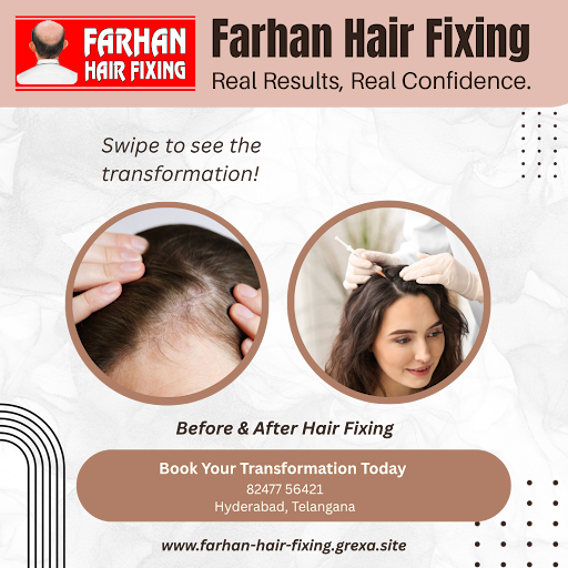 Understanding Non-Surgical Hair Replacement: Benefits and Process post image