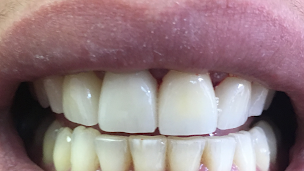 Photo n°1 de Cabinet du Dr Alain Leban à Marseille (Dentiste)