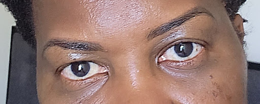 Eunyl brows - Visual