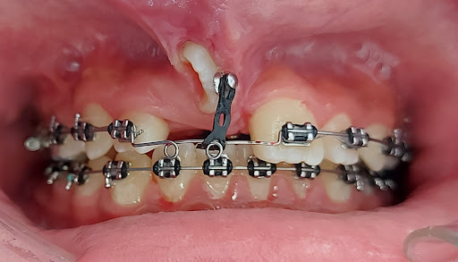 KLIM Odontología Integral - Thumbnail