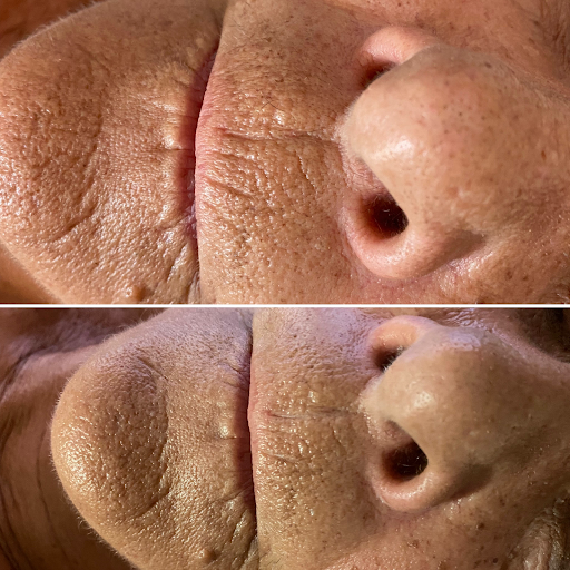 Form AVANA Massage - Thumbnail