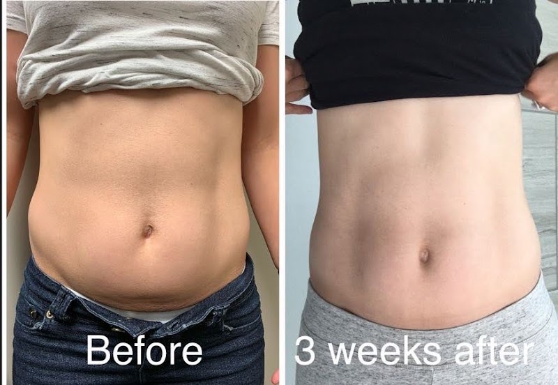 Transcend Total Body Rejuvenation