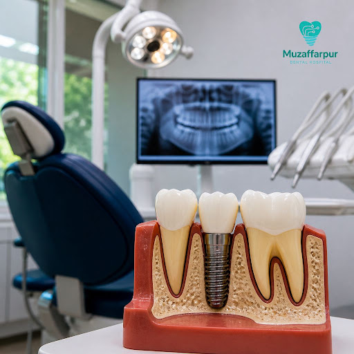 Modern dental implants don’t have to mean long, painful recovery. At Muzaffarpur Dental Hospital,… post image