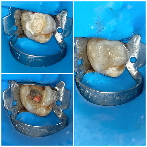 Cirujano dentista Jafet Jiménez (dentaliving) - Thumbnail