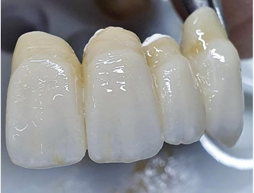 Dentalpoint - Visual