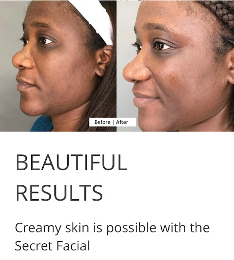 The Secret Skin Spa + Botox - Thumbnail