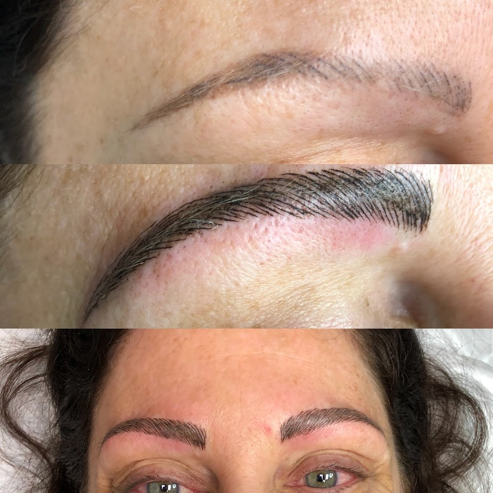 Soft Touch Med Spa Skin And Laser