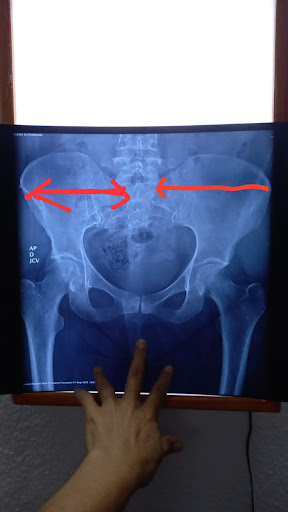 Therafisic - Thumbnail