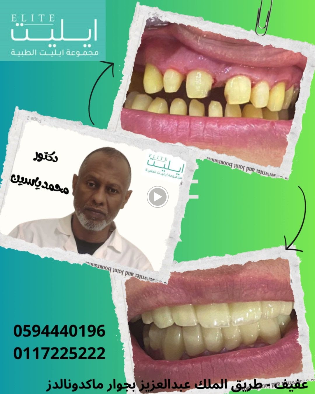 ايليت لطب الأسنان - صورة 3