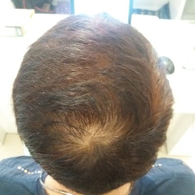 hair-care