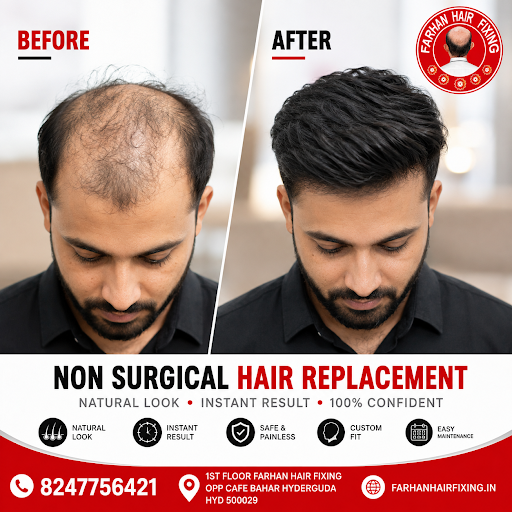 Say goodbye to hair loss and regain your confidence with **Farhan Hair Fixing**. post image