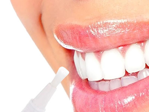 The teeth whitening procedure helps you to brighten your own smile at your convenient time at you…