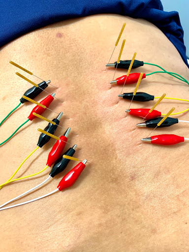 MVP Physio Dr. - Thumbnail