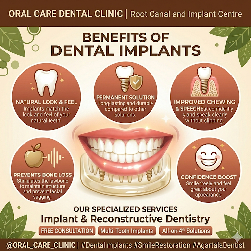 Dental Implant post image