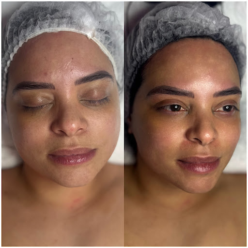 Imelabeautyspa - Thumbnail
