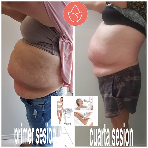 Rossetti Beauty & Spa - Thumbnail