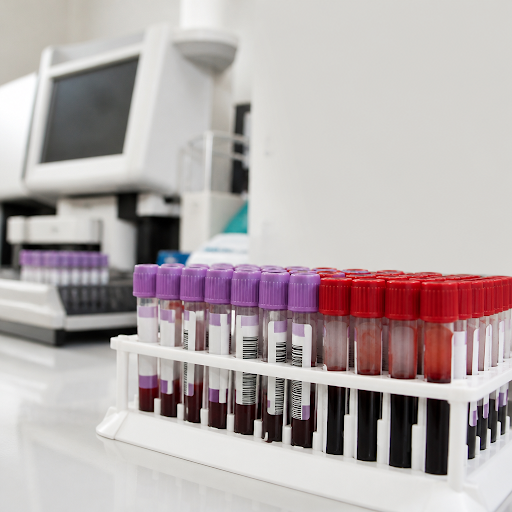 A Complete Blood Count (CBC) is one of the most important tests to understand your overall health… post image