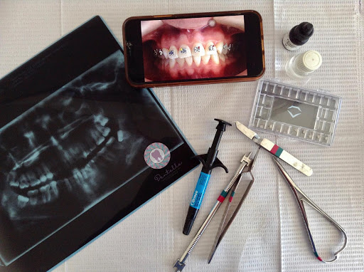 Dentelle - Odontología Familiar y Ortodoncia - Thumbnail