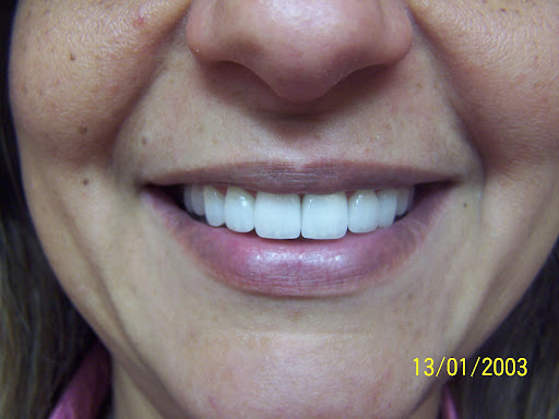 Dentistry On Taunton Ajax - Thumbnail