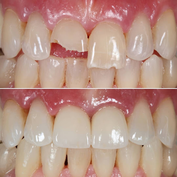 AP&P Dental - Advanced Prosthodontics & Periodontics photo 2