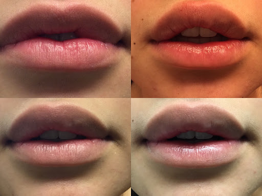 Arizona Facial Plastics