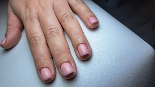 Carole Ongles